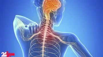 التصلب المتعدد لدى النساء.. علامات تحذيرية مبكرة ومختلفة لا يجب عليكِ تجاهلها